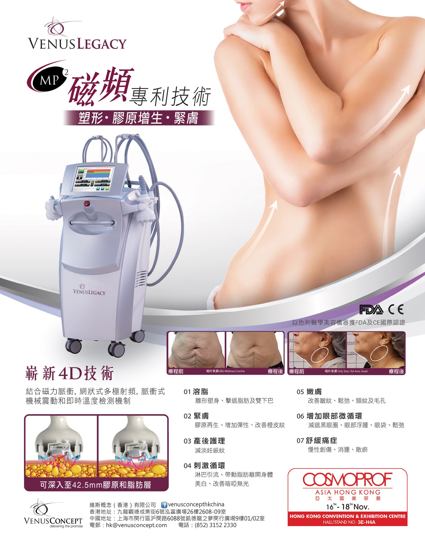 venus legacy near me